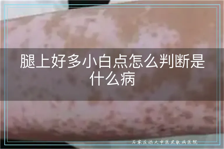 腿上好多小白点怎么判断是什么病