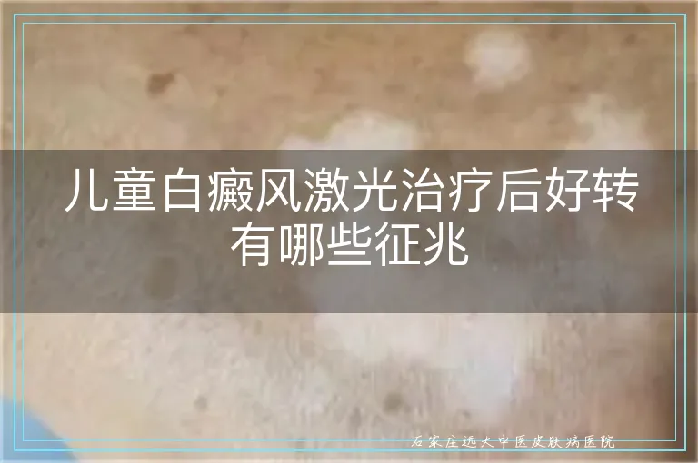 儿童白癜风激光治疗后好转有哪些征兆