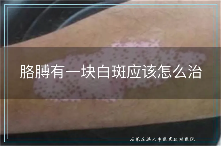 胳膊有一块白斑应该怎么治