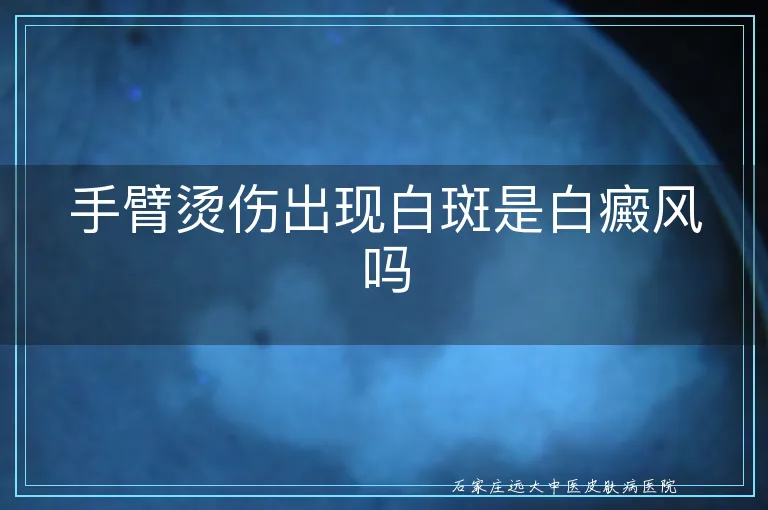 手臂烫伤出现白斑是白癜风吗