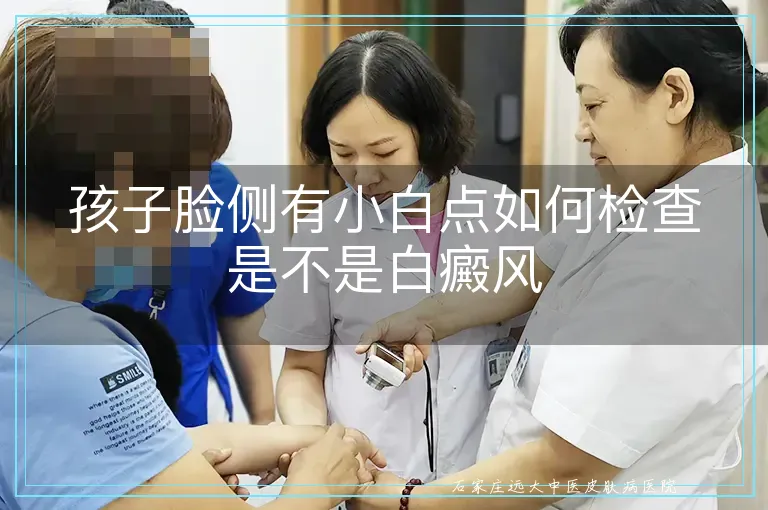 孩子脸侧有小白点如何检查是不是白癜风
