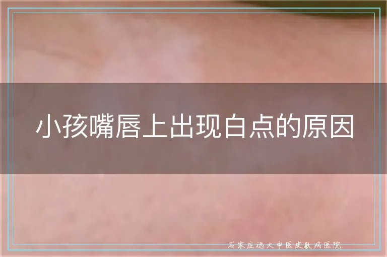 小孩嘴唇上出现白点的原因