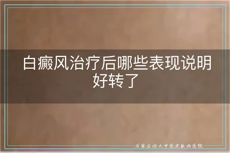 白癜风治疗后哪些表现说明好转了
