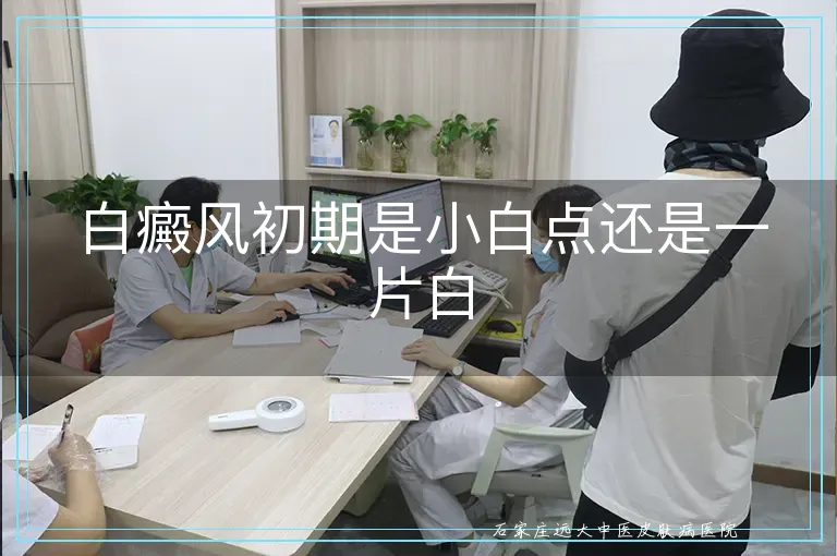 白癜风初期是小白点还是一片白