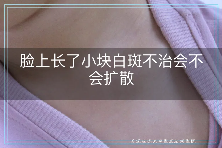 脸上长了小块白斑不治会不会扩散