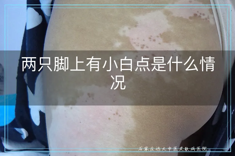 两只脚上有小白点是什么情况
