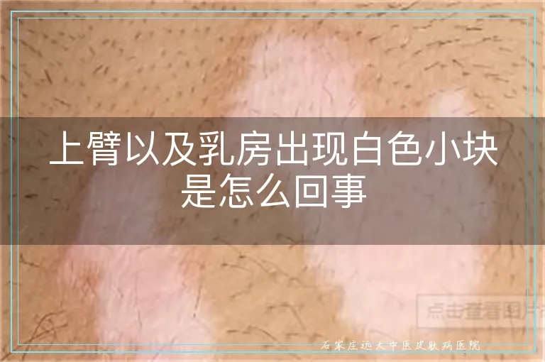 上臂以及乳房出现白色小块是怎么回事