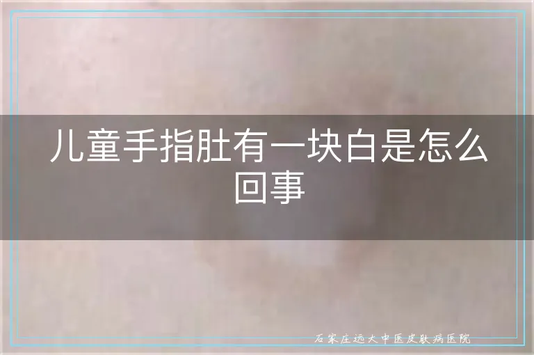 儿童手指肚有一块白是怎么回事