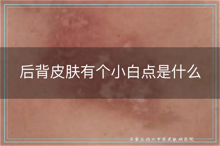后背皮肤有个小白点是什么