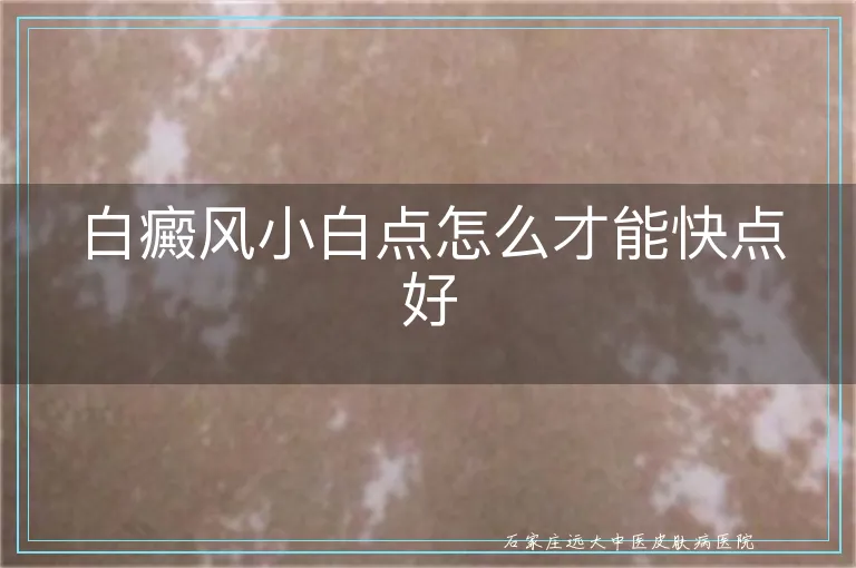 白癜风小白点怎么才能快点好