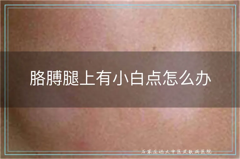 胳膊腿上有小白点怎么办