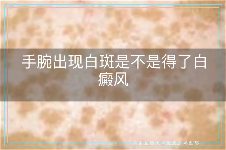 手腕出现白斑是不是得了白癜风