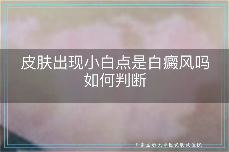 皮肤出现小白点是白癜风吗如何判断