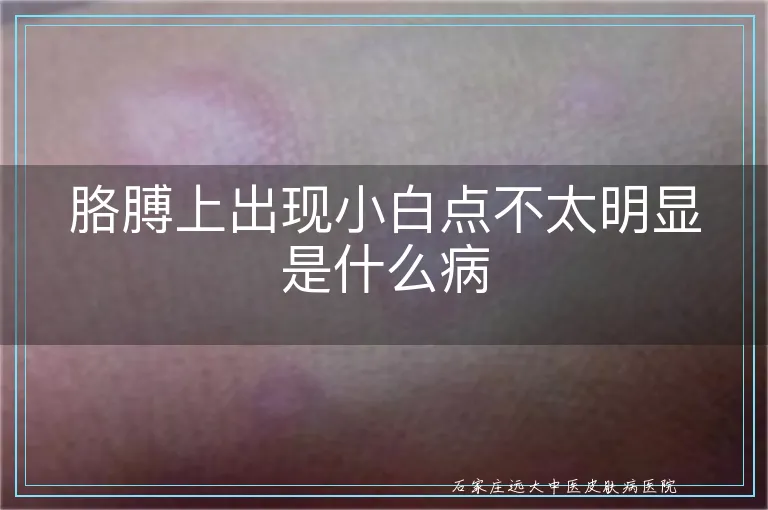 胳膊上出现小白点不太明显是什么病