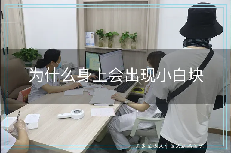 为什么身上会出现小白块