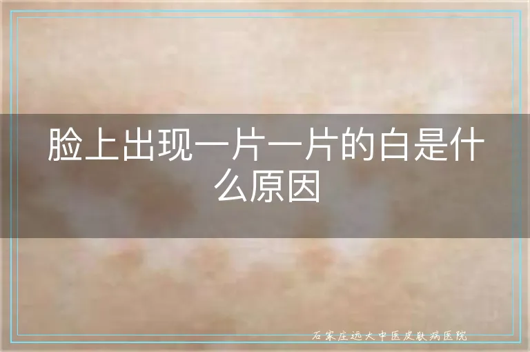 脸上出现一片一片的白是什么原因