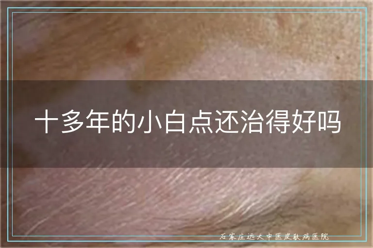 十多年的小白点还治得好吗
