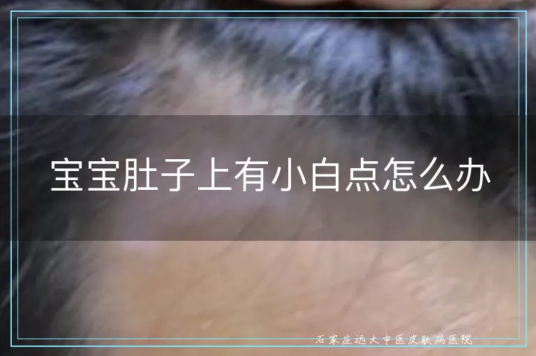 宝宝肚子上有小白点怎么办
