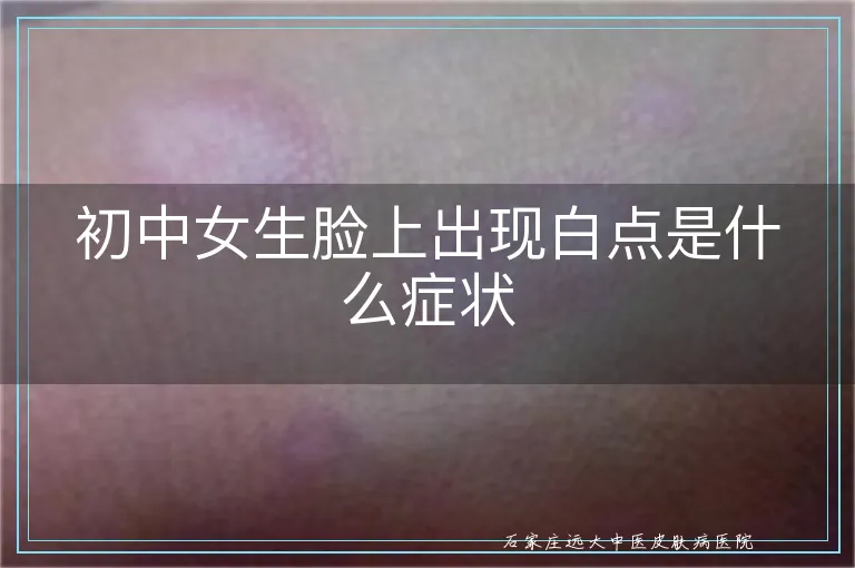 初中女生脸上出现白点是什么症状