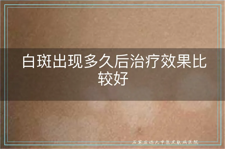白斑出现多久后治疗效果比较好