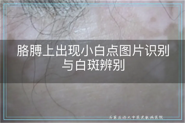 胳膊上出现小白点图片识别与白斑辨别