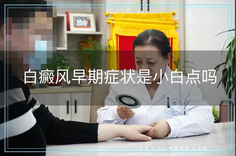 白癜风早期症状是小白点吗