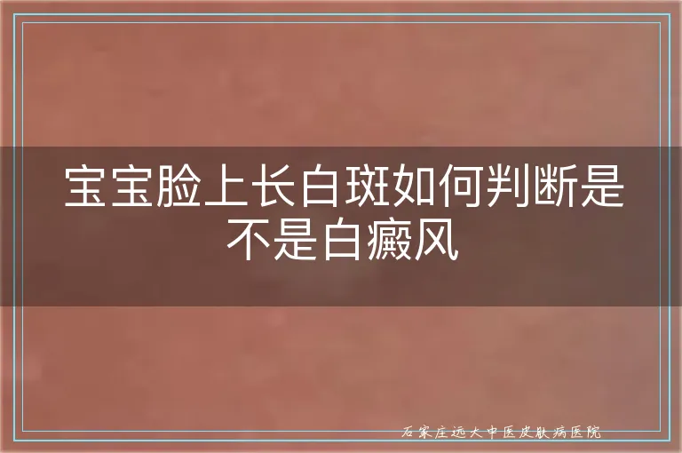 宝宝脸上长白斑如何判断是不是白癜风