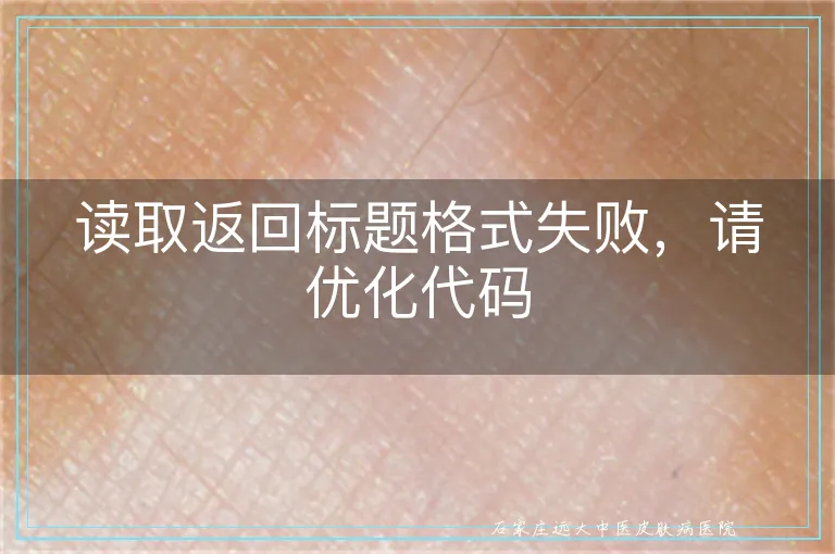 读取返回标题格式失败,请优化代码