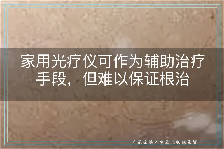 家用光疗仪可作为辅助治疗手段，但难以保证根治