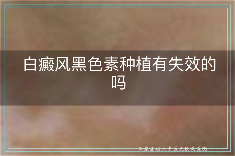 白癜风黑色素种植有失效的吗