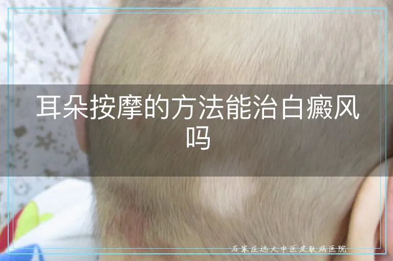 耳朵按摩的方法能治白癜风吗
