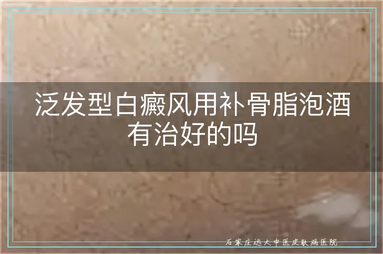 泛发型白癜风用补骨脂泡酒有治好的吗
