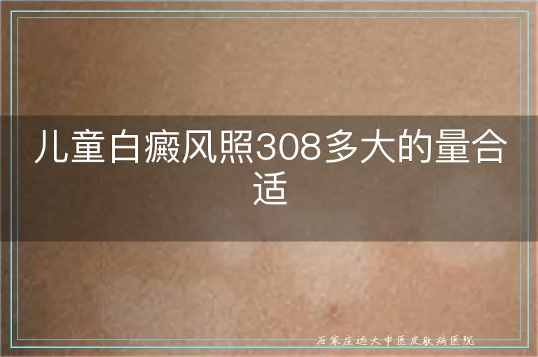 儿童白癜风照308多大的量合适