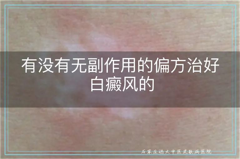 有没有无副作用的偏方治好白癜风的