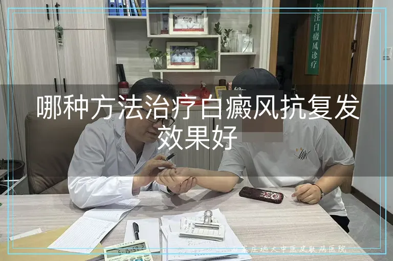 哪种方法治疗白癜风抗复发效果好