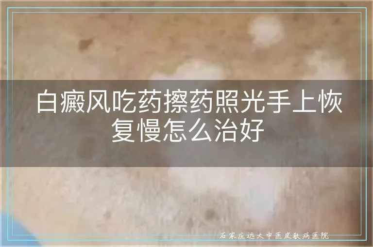 白癜风吃药擦药照光手上恢复慢怎么治好
