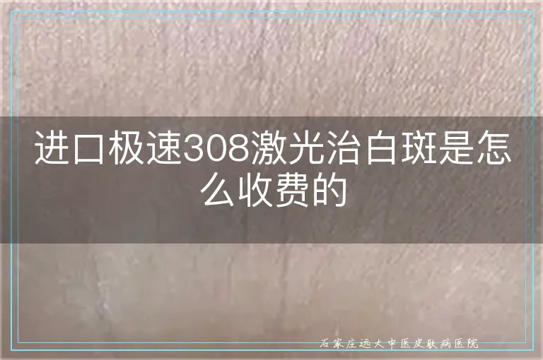 进口极速308激光治白斑是怎么收费的