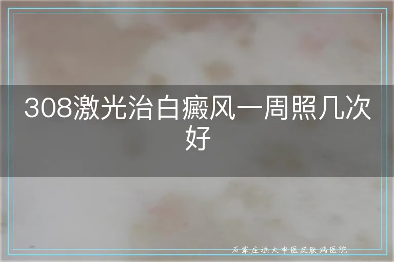 308激光治白癜风一周照几次好