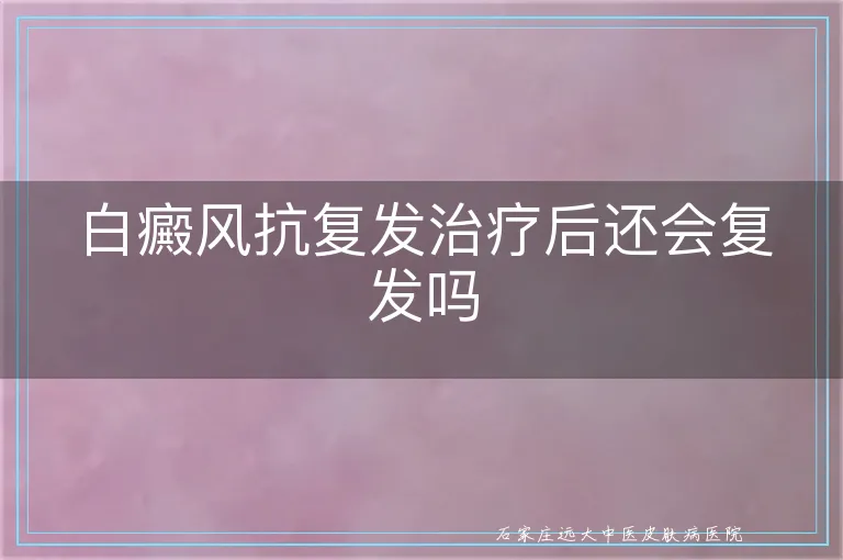 白癜风抗复发治疗后还会复发吗