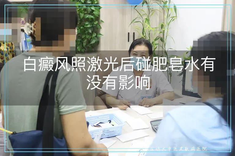 白癜风照激光后碰肥皂水有没有影响