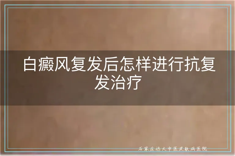 白癜风复发后怎样进行抗复发治疗