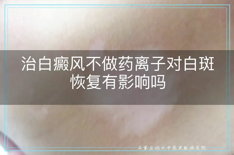 治白癜风不做药离子对白斑恢复有影响吗
