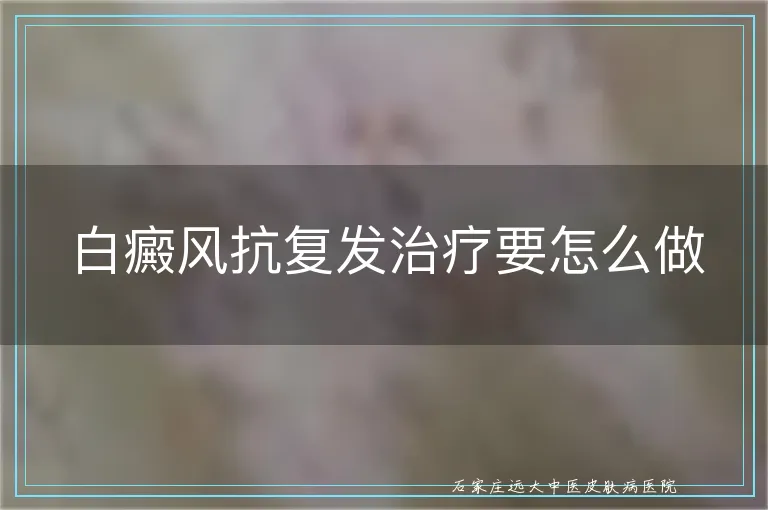 白癜风抗复发治疗要怎么做