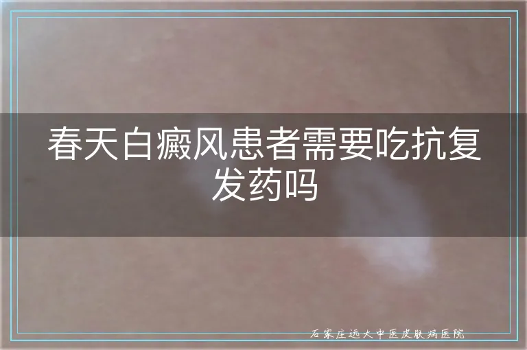 春天白癜风患者需要吃抗复发药吗