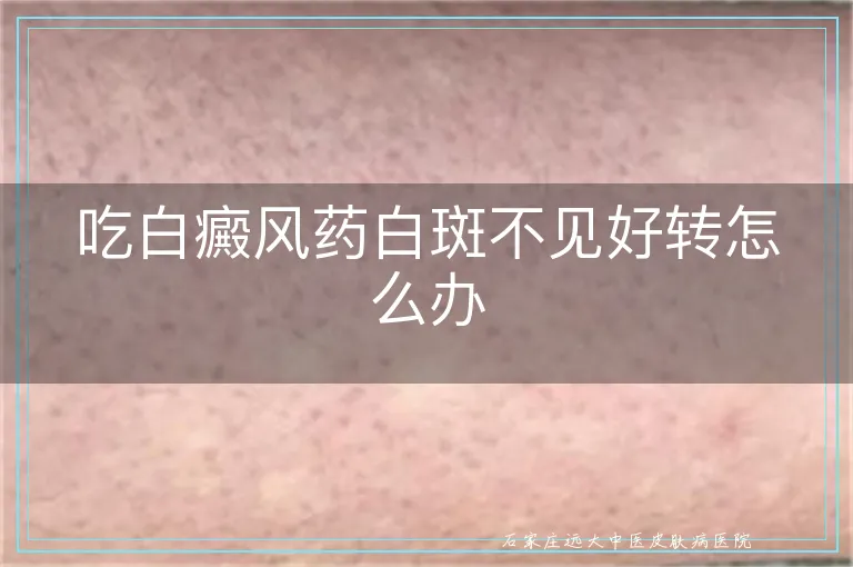 吃白癜风药白斑不见好转怎么办