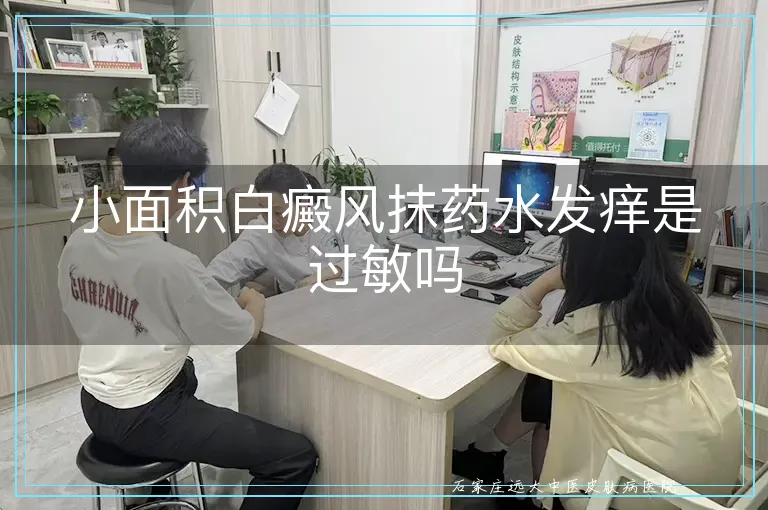 小面积白癜风抹药水发痒是过敏吗
