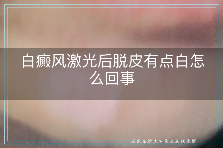 白癜风激光后脱皮有点白怎么回事