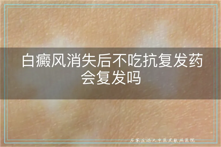 白癜风消失后不吃抗复发药会复发吗
