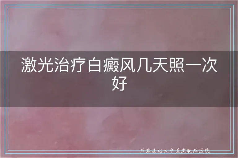 激光治疗白癜风几天照一次好