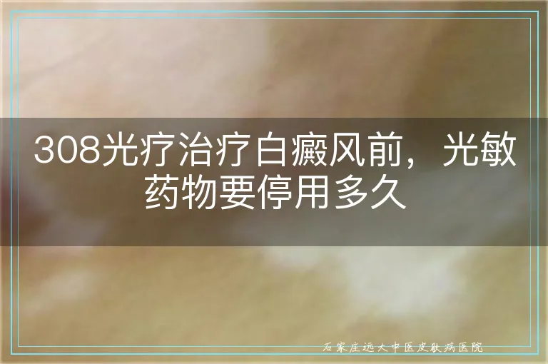 308光疗治疗白癜风前,光敏药物要停用多久